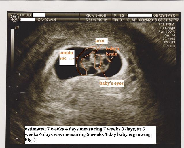 Baby7w4d1private-3.jpg