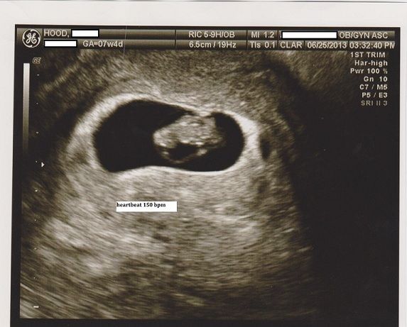 Baby7w4d2private-3.jpg