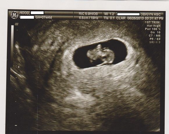 Baby7w4d5private-3.jpg