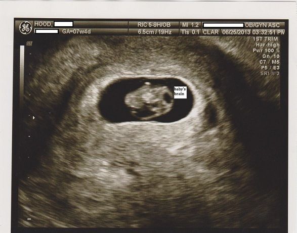 Baby7w4d6private-3.jpg