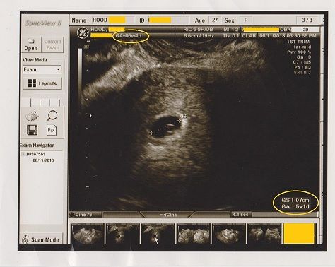 ultrasound001privateinfo-2.jpg