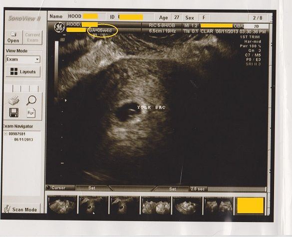 ultrasound002privateinfo-2.jpg